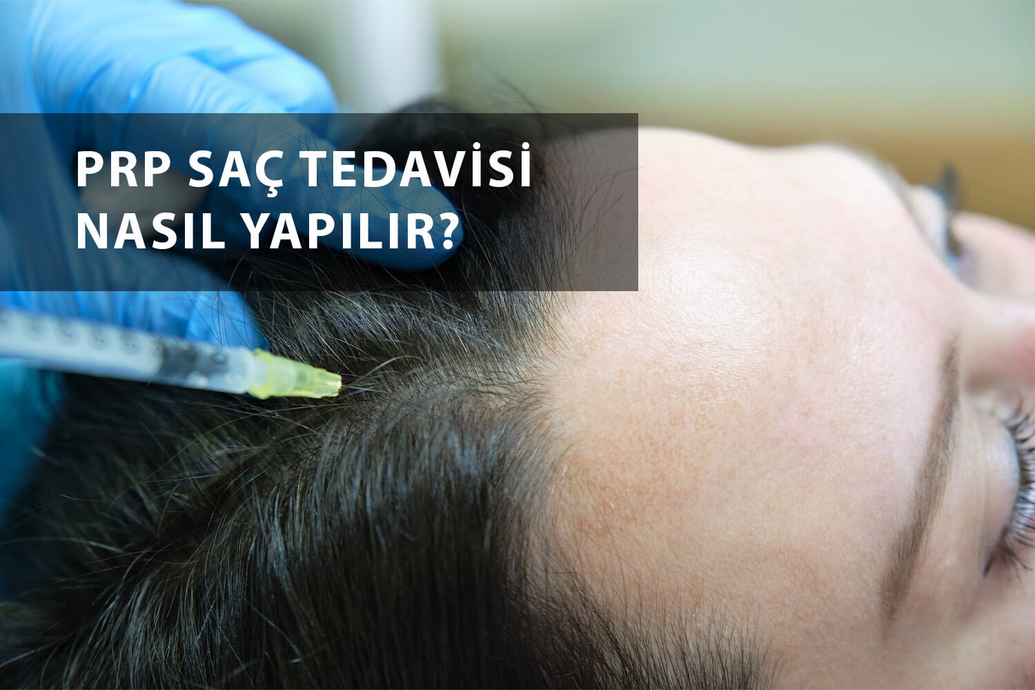 PRP saç tedavisi nasıl yapılır