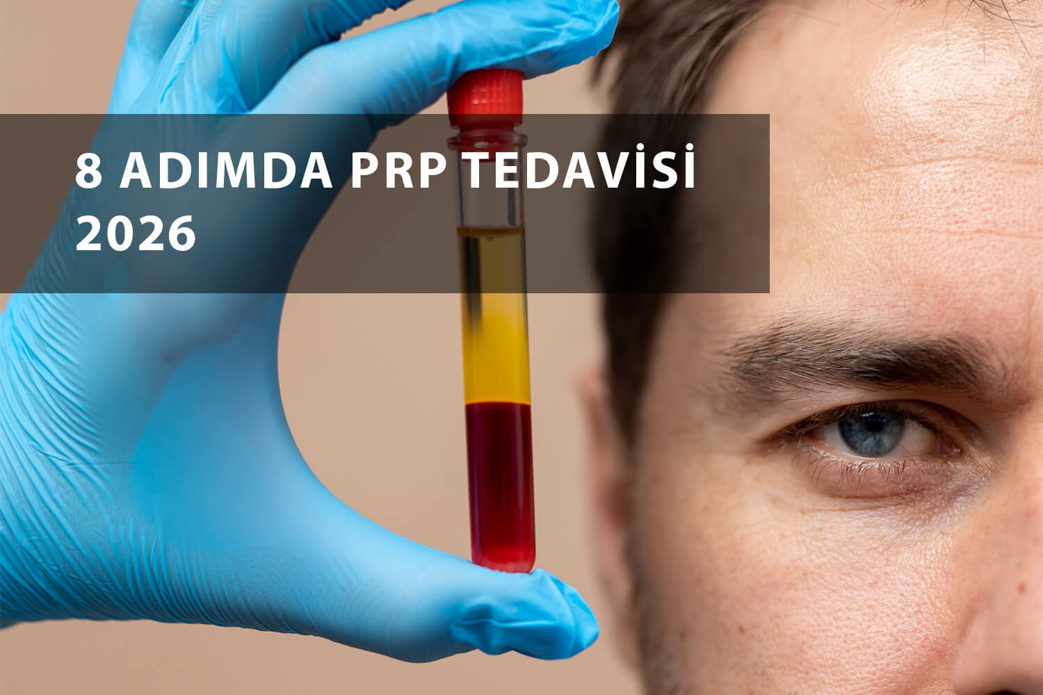 8 Adımda PRP Tedavisi 2026