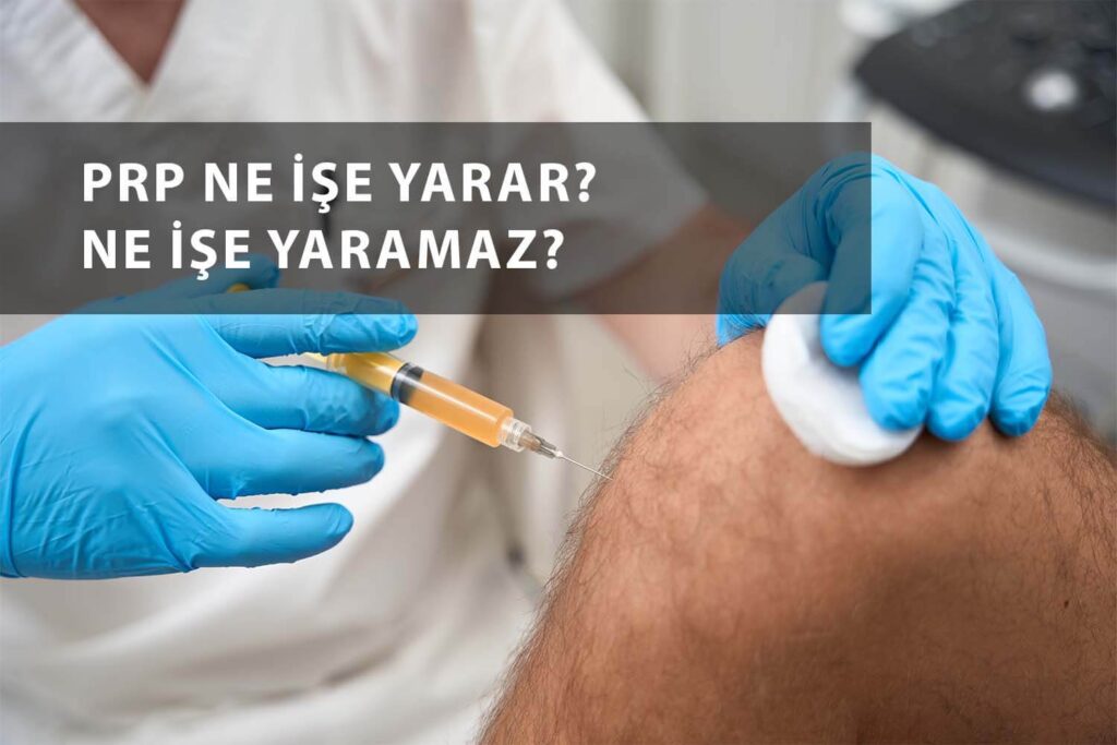 PRP ne işe yarar ve yaramaz görseli