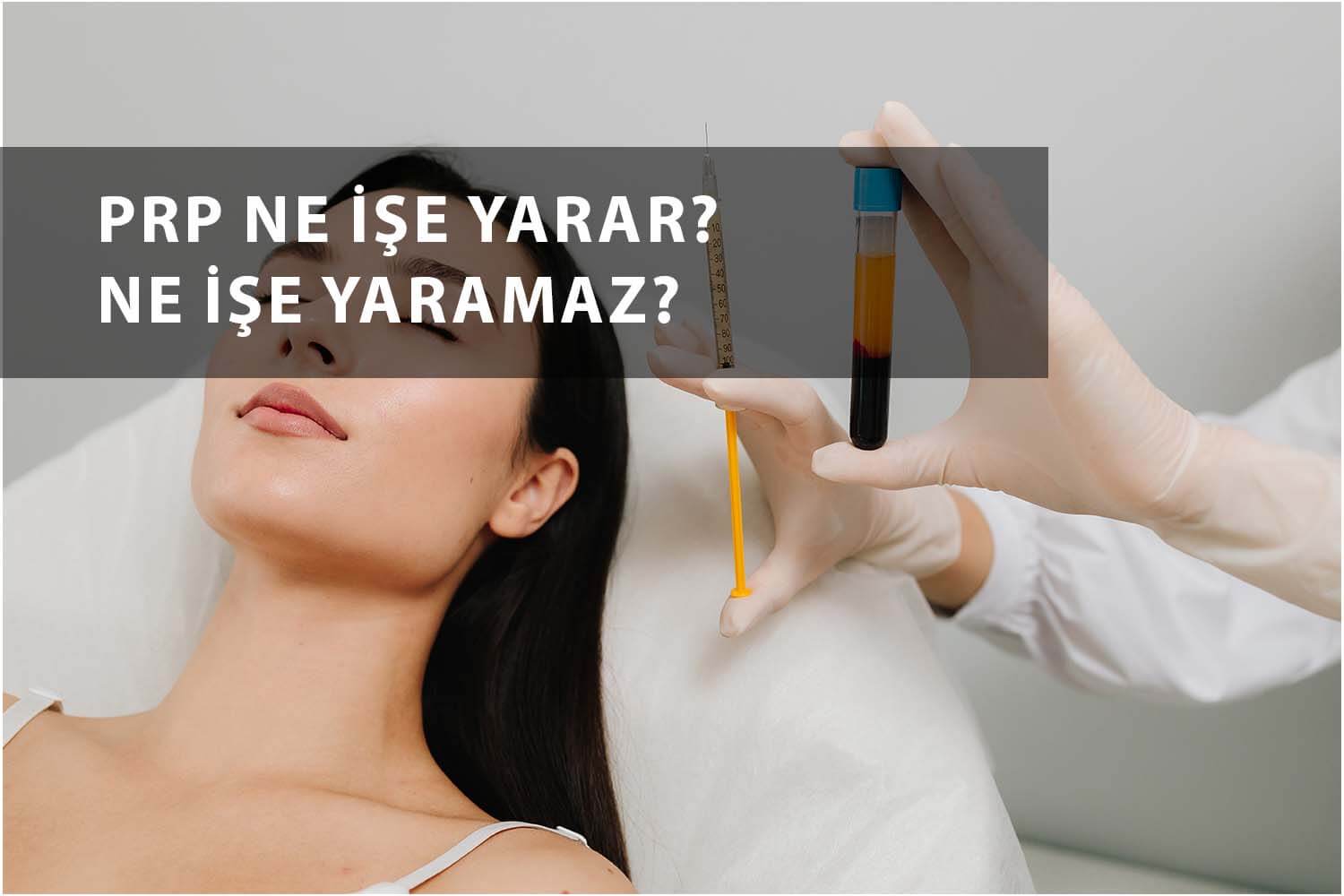 PRP ne işe yarar